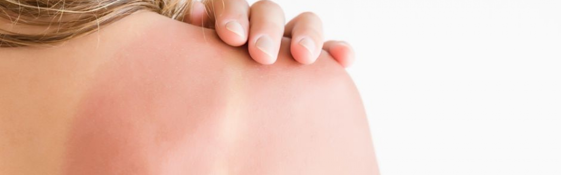 El sol y el envejecimiento inducido