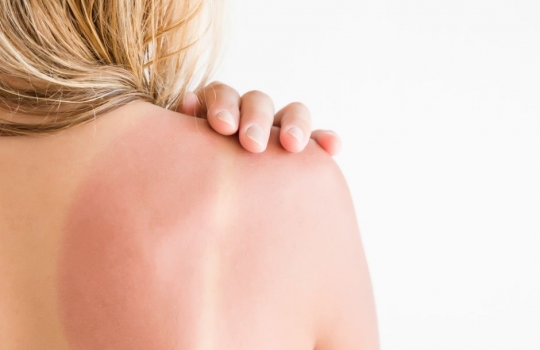 El sol y el envejecimiento inducido